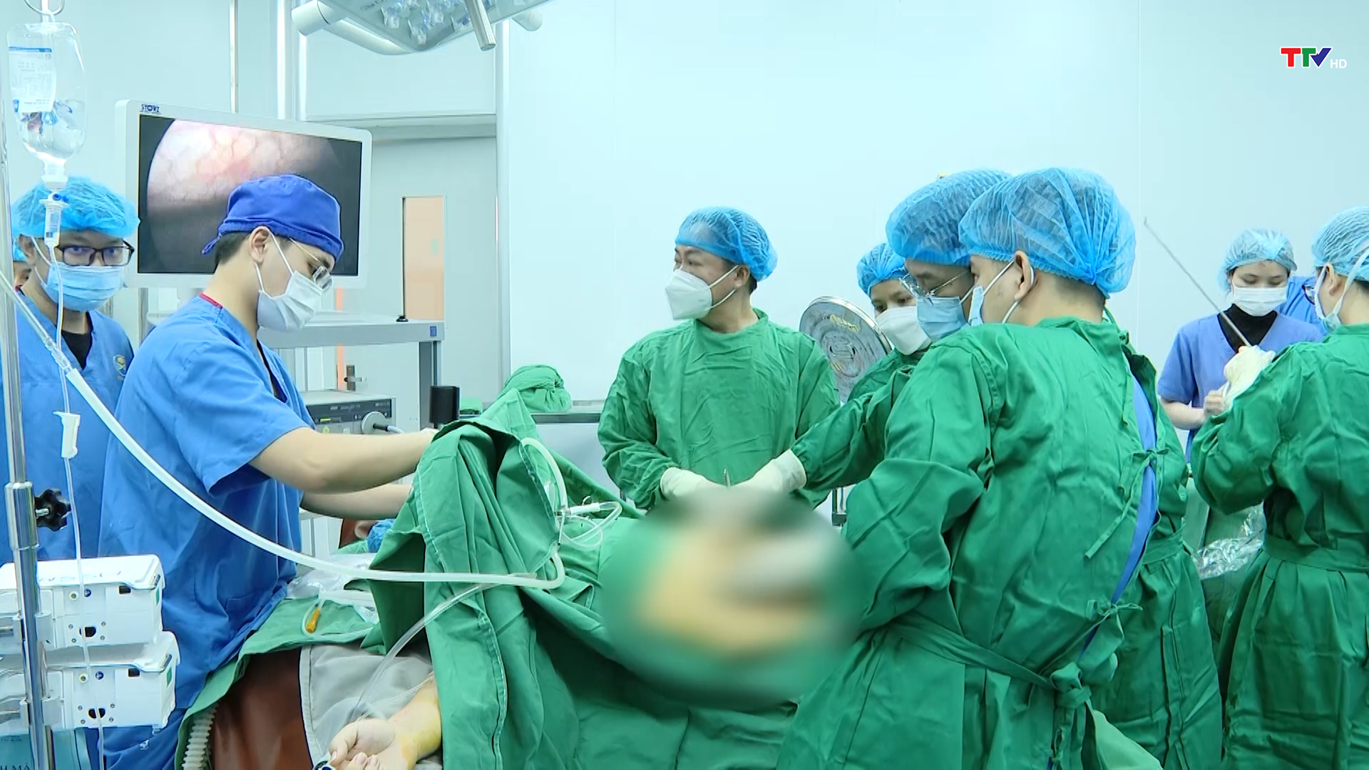 Bệnh viện Ung bướu Thanh Hóa tiếp nhận chuyển giao thành công kỹ thuật cắt gan trong điều trị ung thư gan  - Ảnh 1.