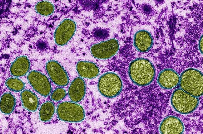 WHO đặt tên mới cho các chủng virus gây bệnh đậu mùa khỉ - Ảnh 1.