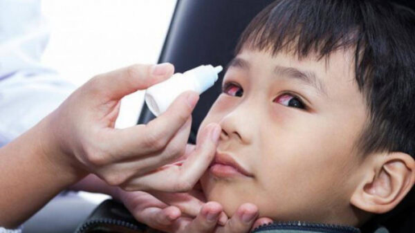 Cảnh báo dịch đau mắt đỏ ở trẻ em kèm theo nhiều biến chứng - Ảnh 2.
