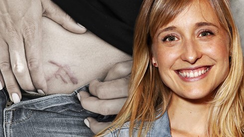 Nữ diễn viên Allison Mack và hình xăm biểu tượng của hội kín NXIVM - Ảnh: DAILY BEAST