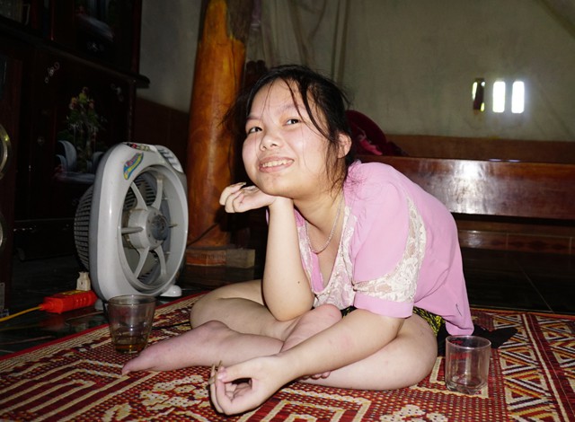 Nguyễn Thị Sương cũng mắc căn bệnh giống em trai. Năm nay vào cấp 3, Sương phải nghỉ học. Em đang dự tính học thêu tranh để có thêm thu nhập phụ bố mẹ.