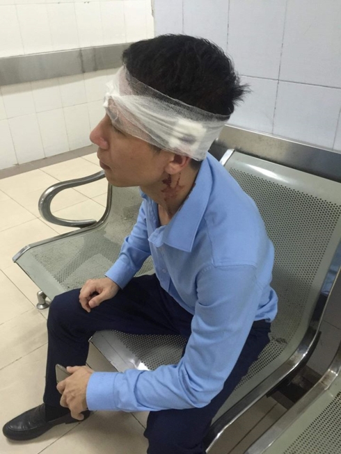 Anh Phúc bị hành hung đánh chảy máu đầu.
