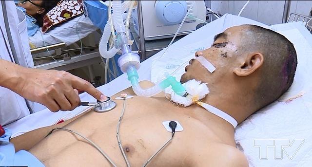 Kể từ chiều ngày 27 tết Âm Lịch vừa qua, anh Nguyễn Văn Duy, 23 tuổi quê ở xã Nga Phú, huyện Nga Sơn vẫn nằm bất động trên giường bệnh bởi tai nạn giao thông.