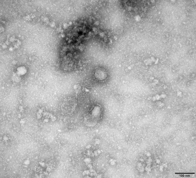 Hình ảnh kính hiển vi điện tử truyền qua (TEM) của virus corona. Ảnh: Reuters