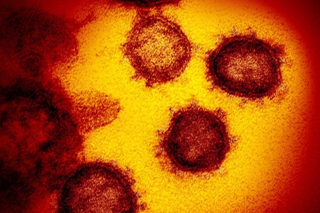 Các nhà khoa học nhận định virus corona chủng mới có thể rất khác so với SARS. Ảnh: AP