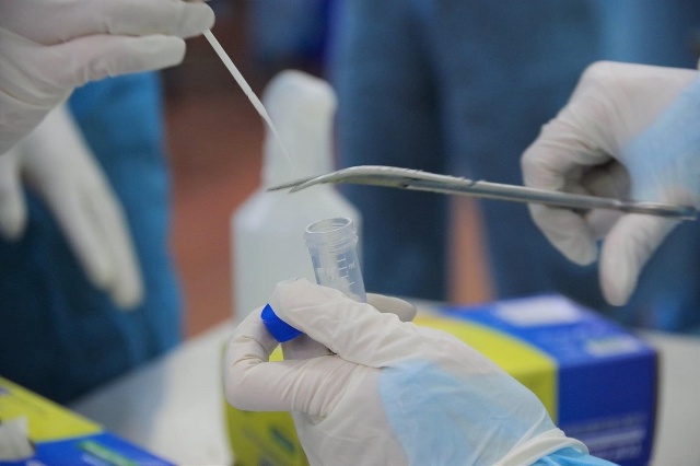 Lấy mẫu xét nghiệm tìm virus SARS-CoV-2 (Ảnh CTV)