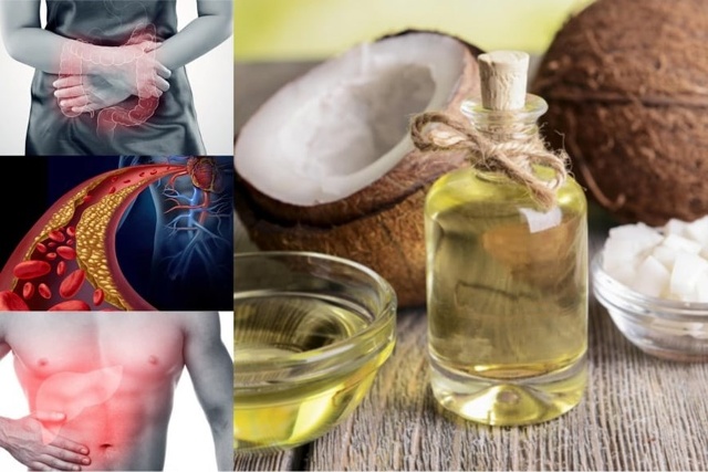 Nếu bạn đang có những biểu hiện này, nên hạn chế sử dụng dầu dừa. Đồ hoạ: A.N.