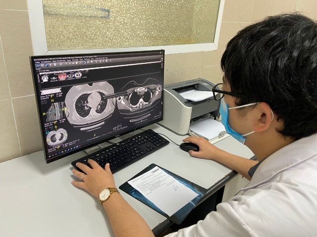Hình ảnh phim của một bệnh nhân tổn thương phổi do Covid-19. Ảnh: Bệnh viện Thanh Nhàn