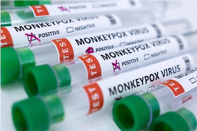 Singapore phát hiện ca bệnh đậu mùa khỉ nhập cảnh. Ảnh chụp màn hình