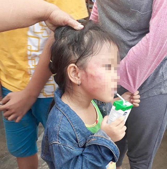 Những vụ bạo hành trẻ mầm non xôn xao dư luận năm 2018 - 2 Những vụ bạo hành trẻ mầm non xôn xao dư luận năm 2018 - 2