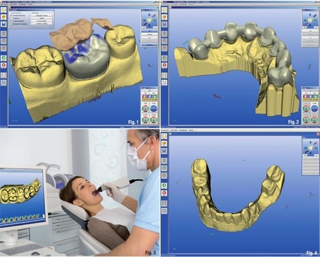 In sinh học: Ứng dụng in 3D trong y khoa - 10 In sinh học: Ứng dụng in 3D trong y khoa - 10
