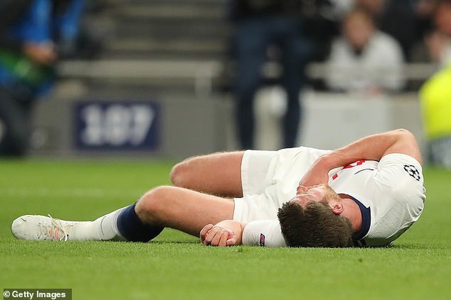 Vertonghen đổ máu trong ngày Tottenham bại trận trước Ajax - 2 Vertonghen đổ máu trong ngày Tottenham bại trận trước Ajax - 2