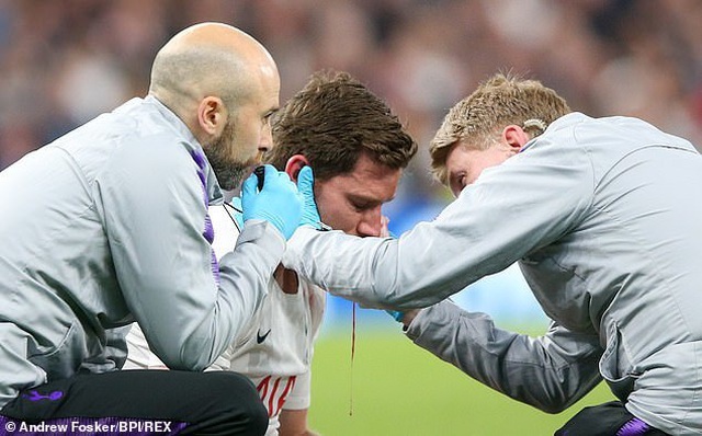 Vertonghen đổ máu trong ngày Tottenham bại trận trước Ajax - 7 Vertonghen đổ máu trong ngày Tottenham bại trận trước Ajax - 7