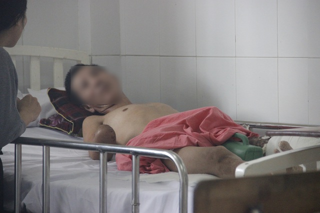 Liên tiếp 2 trường hợp phải đoạn tứ chi vì bỏng điện - 2 Liên tiếp 2 trường hợp phải đoạn tứ chi vì bỏng điện - 2