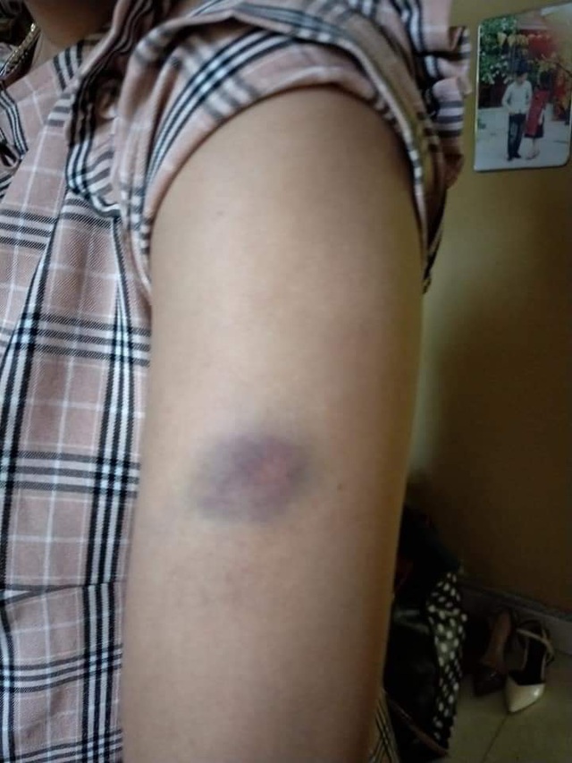 C&ocirc;ng an l&agrave;m việc với người chồng đ&aacute;nh vợ đang mang thai v&igrave; tội mua h&agrave;ng qua mạng - 2