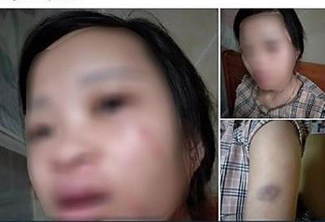 C&ocirc;ng an l&agrave;m việc với người chồng đ&aacute;nh vợ đang mang thai v&igrave; tội mua h&agrave;ng qua mạng - 1