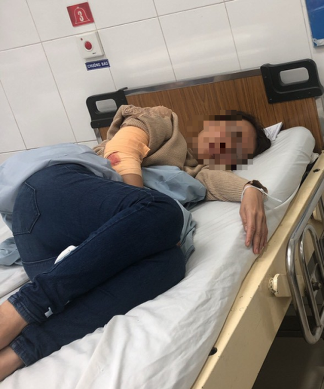 Điều tra nh&oacute;m c&ocirc;n đồ bịt mặt ch&eacute;m trọng thương chủ qu&aacute;n c&agrave; ph&ecirc; - 1