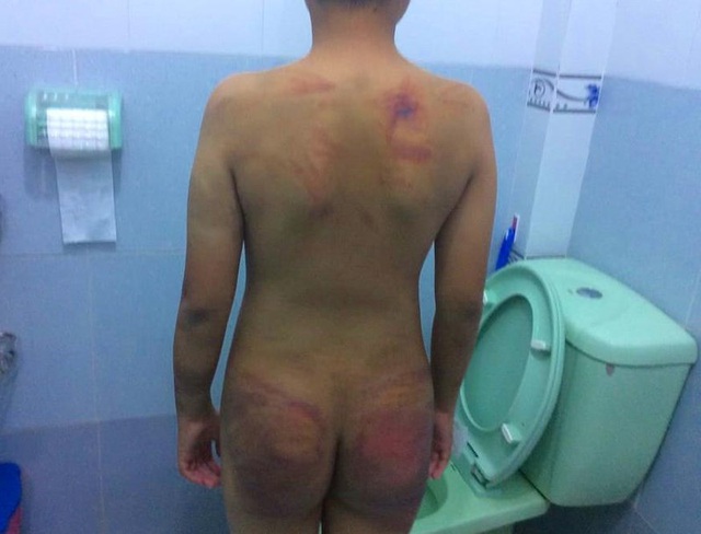 Bé trai 11 tuổi bị 1 người tu hành đánh dã man - 4 Bé trai 11 tuổi bị 1 người tu hành đánh dã man - 4