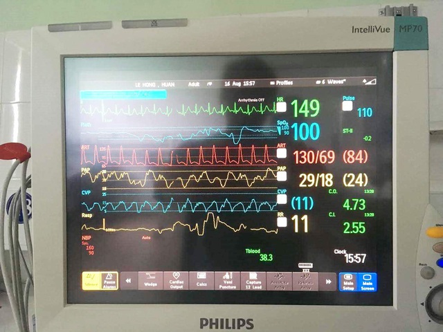Bệnh nhân hồi phục thần tốc sau ca ghép tim thành công - 4 Bệnh nhân hồi phục thần tốc sau ca ghép tim thành công - 4