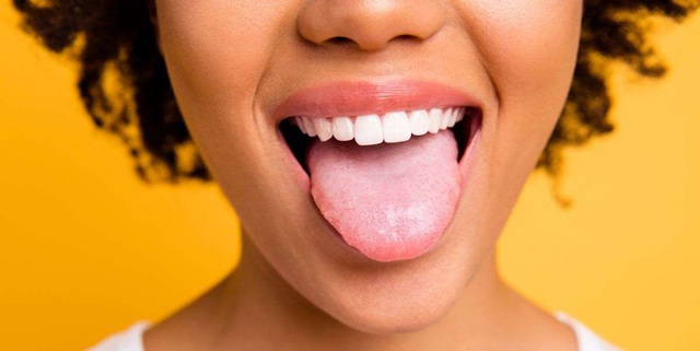 Sưng lưỡi là dấu hiệu của bệnh gì? - 1 Sưng lưỡi là dấu hiệu của bệnh gì? - 1