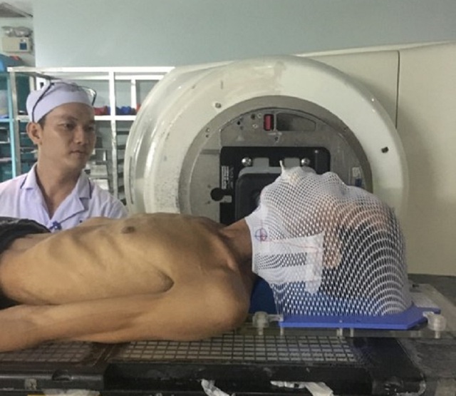 Nhiều người bỗng nhi&ecirc;n phải cắt lưỡi v&igrave; ung thư - 2