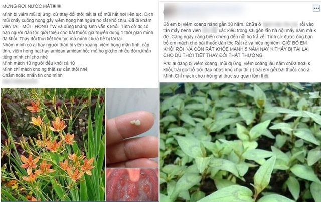 Bác sĩ phát hoảng với những mẹo độc chữa viêm xoang chưa từng xuất hiện trong y văn - 1 Bác sĩ phát hoảng với những mẹo độc chữa viêm xoang chưa từng xuất hiện trong y văn - 1