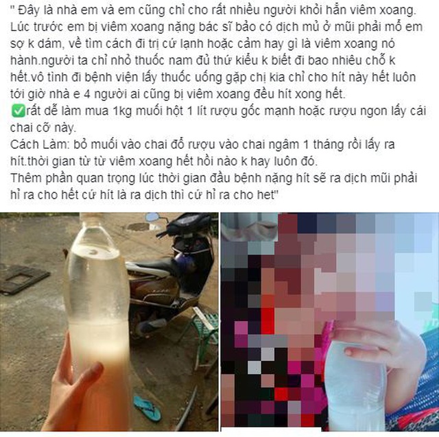 Bác sĩ phát hoảng với những mẹo độc chữa viêm xoang chưa từng xuất hiện trong y văn - 5 Bác sĩ phát hoảng với những mẹo độc chữa viêm xoang chưa từng xuất hiện trong y văn - 5