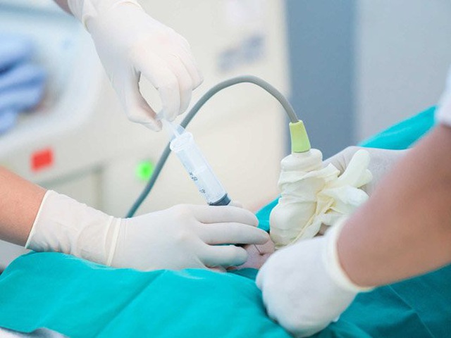 Làm thế nào để quyết định có nên chọc ối hay không? - 1 Làm thế nào để quyết định có nên chọc ối hay không? - 1
