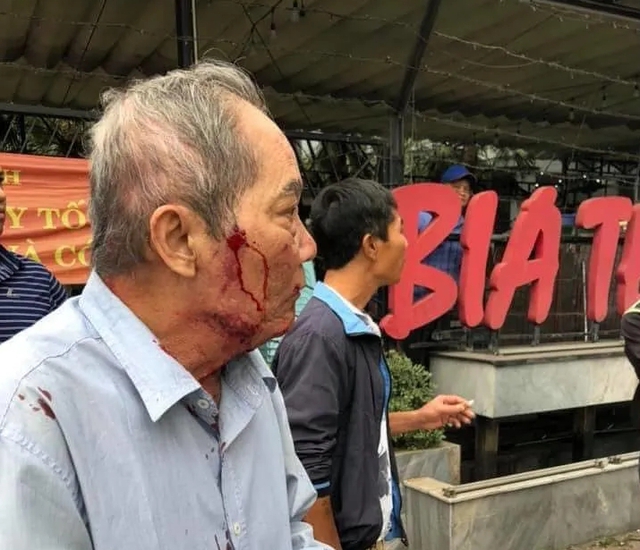 Vụ cụ ông 80 tuổi bị hành hung: Chuyển hồ sơ lên công an quận - 1 Vụ cụ ông 80 tuổi bị hành hung: Chuyển hồ sơ lên công an quận - 1