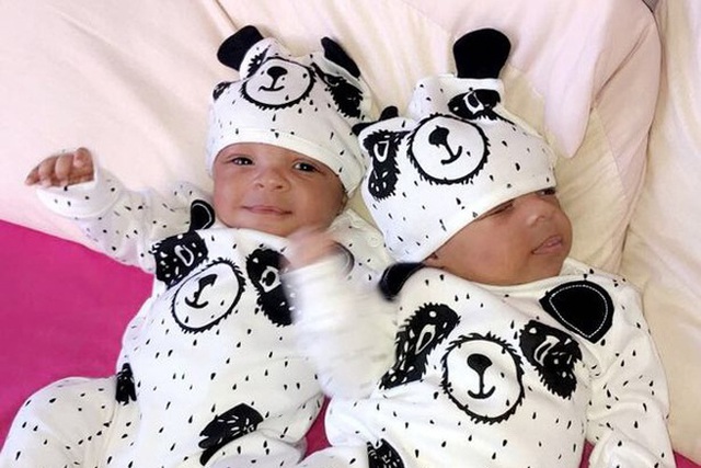 Cặp song sinh vừa ch&agrave;o đời đ&atilde; bị ung thư m&aacute;u, một b&eacute; qua đời ngay sau đ&oacute; - 1