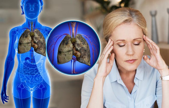 5 triệu chứng ung thư phổi nhiều người kh&ocirc;ng hề hay biết - 5