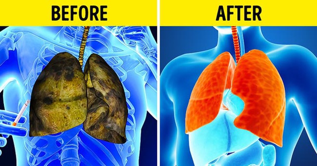 5 triệu chứng ung thư phổi nhiều người kh&ocirc;ng hề hay biết - 6