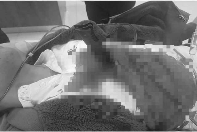 Quảng Bình: Kịp thời cứu bệnh nhân bị dao đâm xuyên tim - 1 Quảng Bình: Kịp thời cứu bệnh nhân bị dao đâm xuyên tim - 1