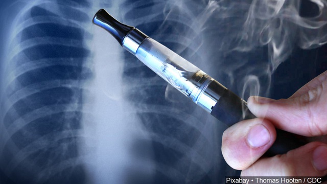 Thêm một bằng chứng quan trọng về khả năng gây ung thư của thuốc lá điện tử - 3