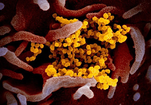 Những hình ảnh rõ nét đầu tiên về virus corona mới trên tế bào con người - 1