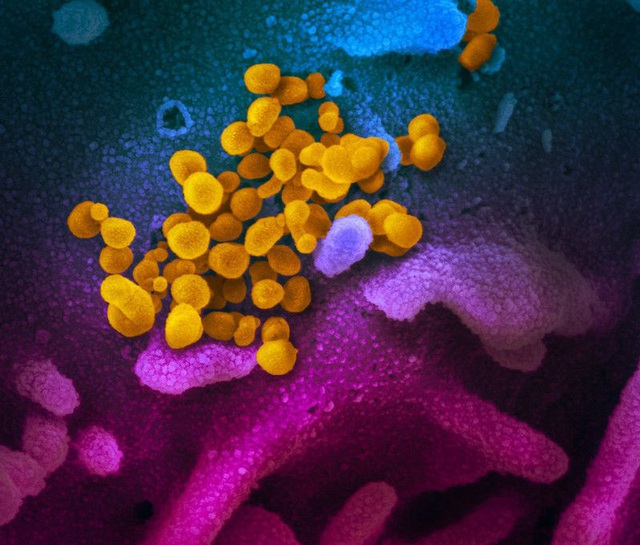Những hình ảnh rõ nét đầu tiên về virus corona mới trên tế bào con người - 2