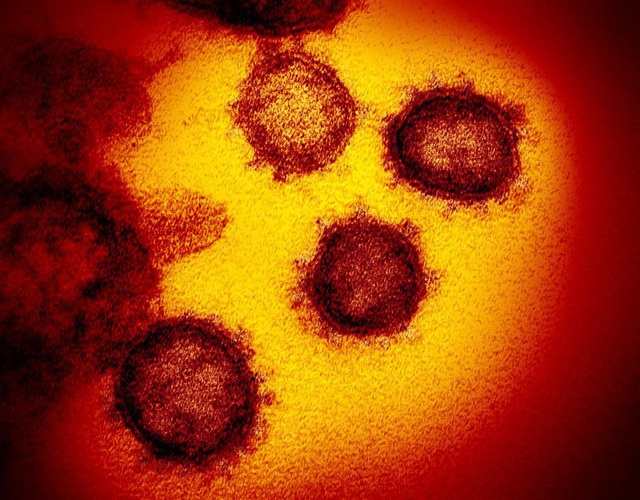 Những hình ảnh rõ nét đầu tiên về virus corona mới trên tế bào con người - 3