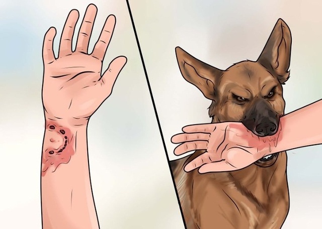 Xử lý thế nào khi bị chó dại cắn