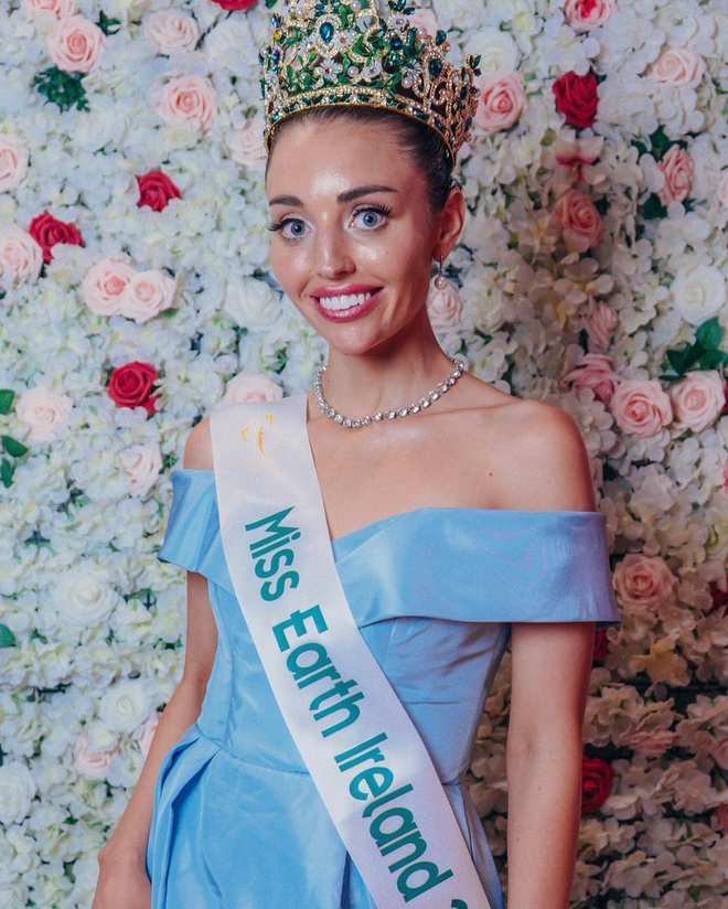 Tranh cãi về nhan sắc tân Hoa hậu Trái đất Ireland - 1