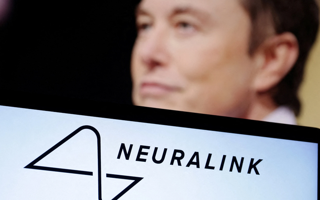 Ảnh minh họa về việc Neuralink của tỉ phú Elon Musk thực hiện thành công ca thứ 2 cấy chip vào não người

