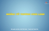 Phóng sự: Những vết thương chưa lành