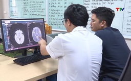 Đột quỵ gia tăng ở người trẻ tuổi