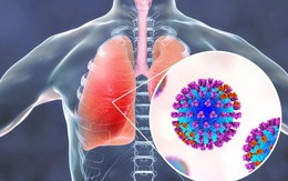 Giải pháp phòng chống viêm phổi do nhiễm virus hợp bào hô hấp