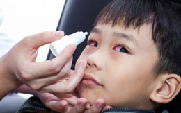 Cảnh báo dịch đau mắt đỏ ở trẻ em kèm theo nhiều biến chứng