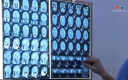 Thanh Hoá tăng cường phòng, chống bệnh viêm não Nhật Bản