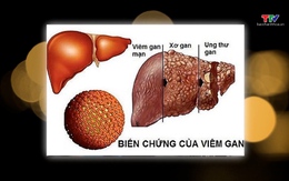 Tăng cường phòng, chống viêm gan virus, hướng tới loại trừ bệnh vào năm 2030