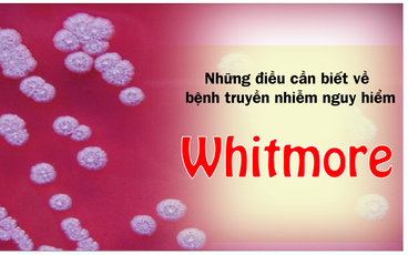 Những điều cần biết về bệnh truyền nhiễm nguy hiểm Whitmore